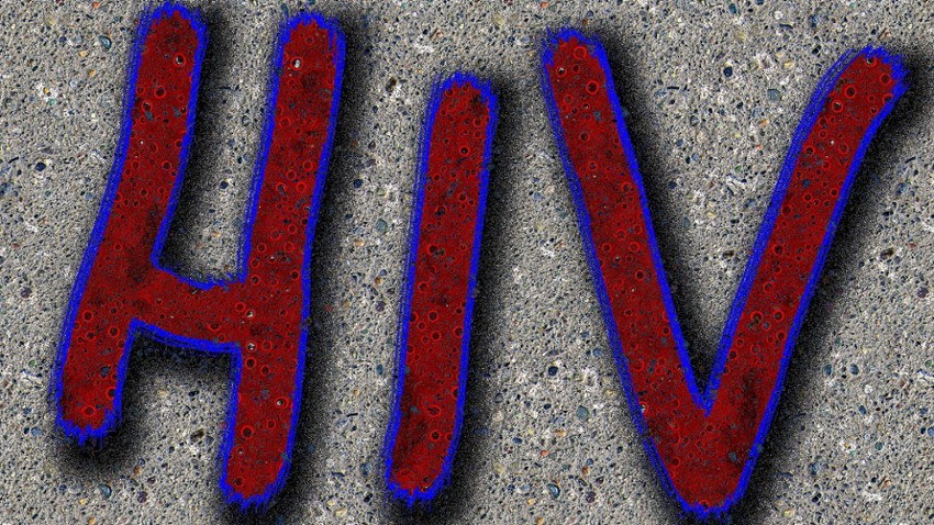 Stock photo - HIV